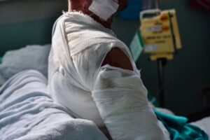 Understanding Paralysis Injury Claims What Mississippi Victims Need to Know